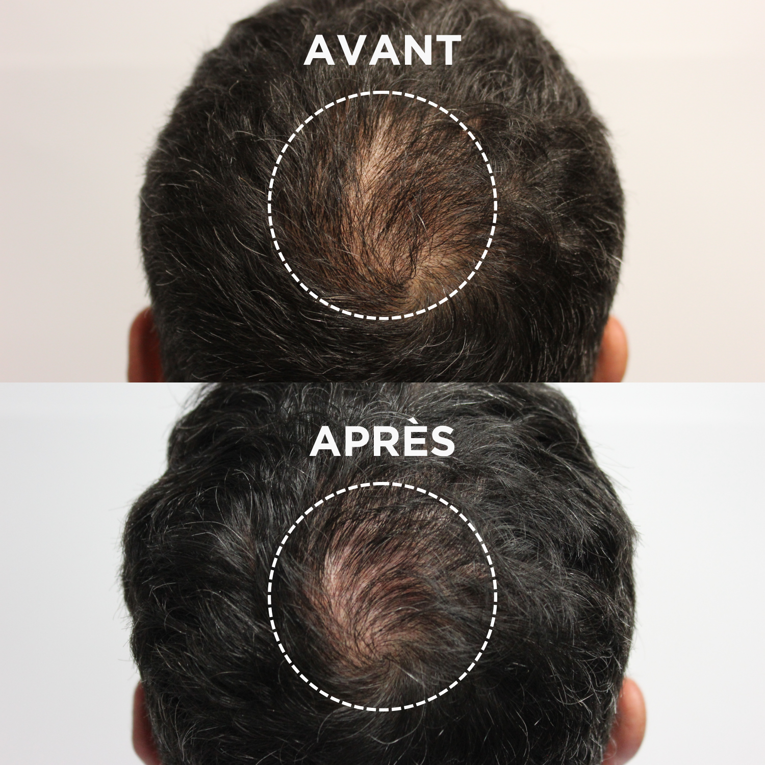 THICKER HAIR SERUM (Sérum anti-chute densifiant)